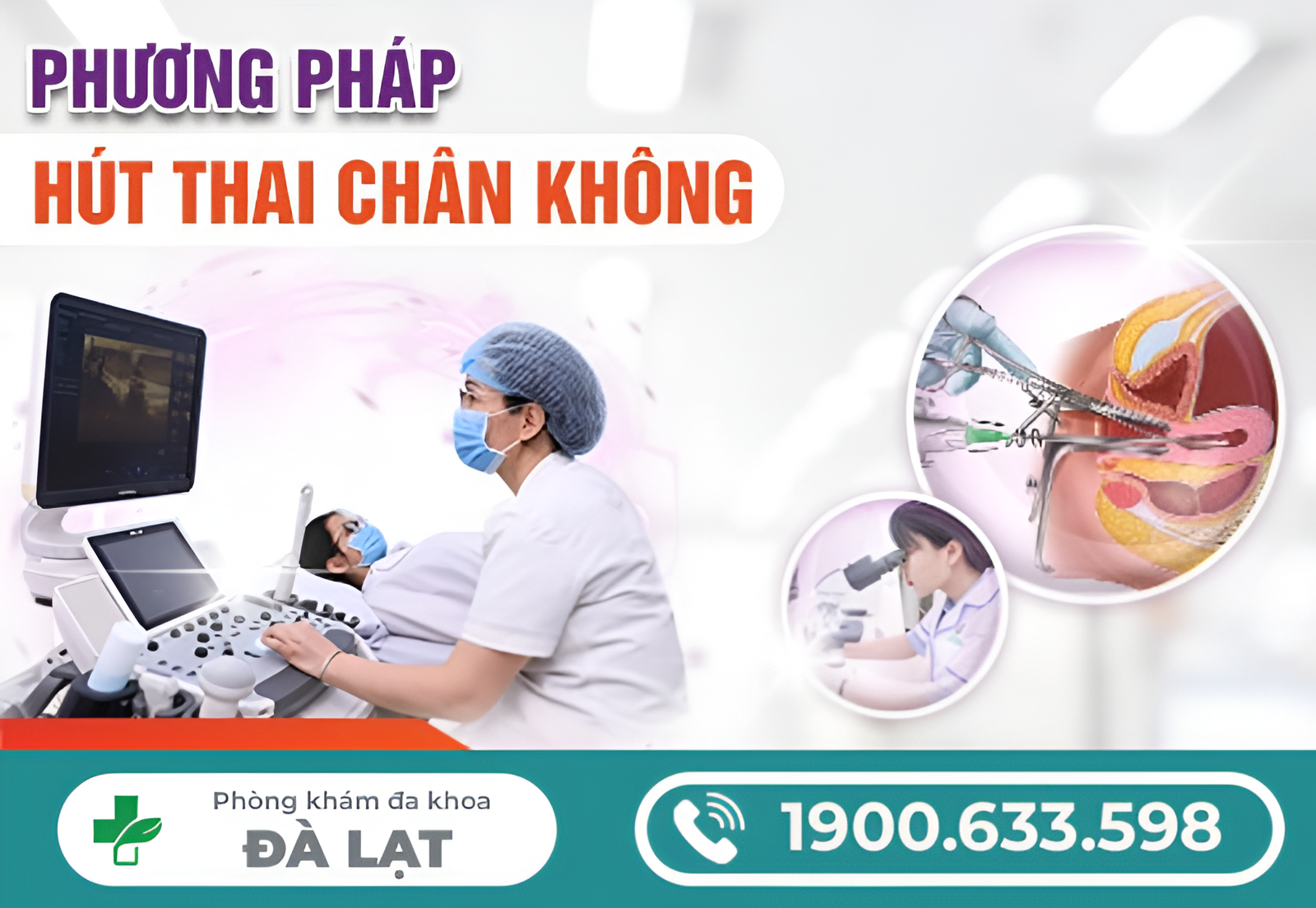 Hình ảnh minh họa